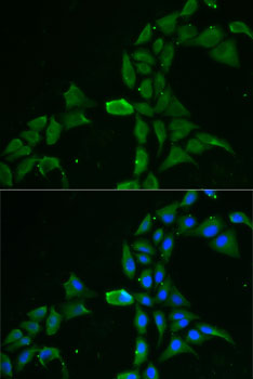 Immunofluorescence analysis of MCF7 cells using DDX1 Polyclonal Antibody