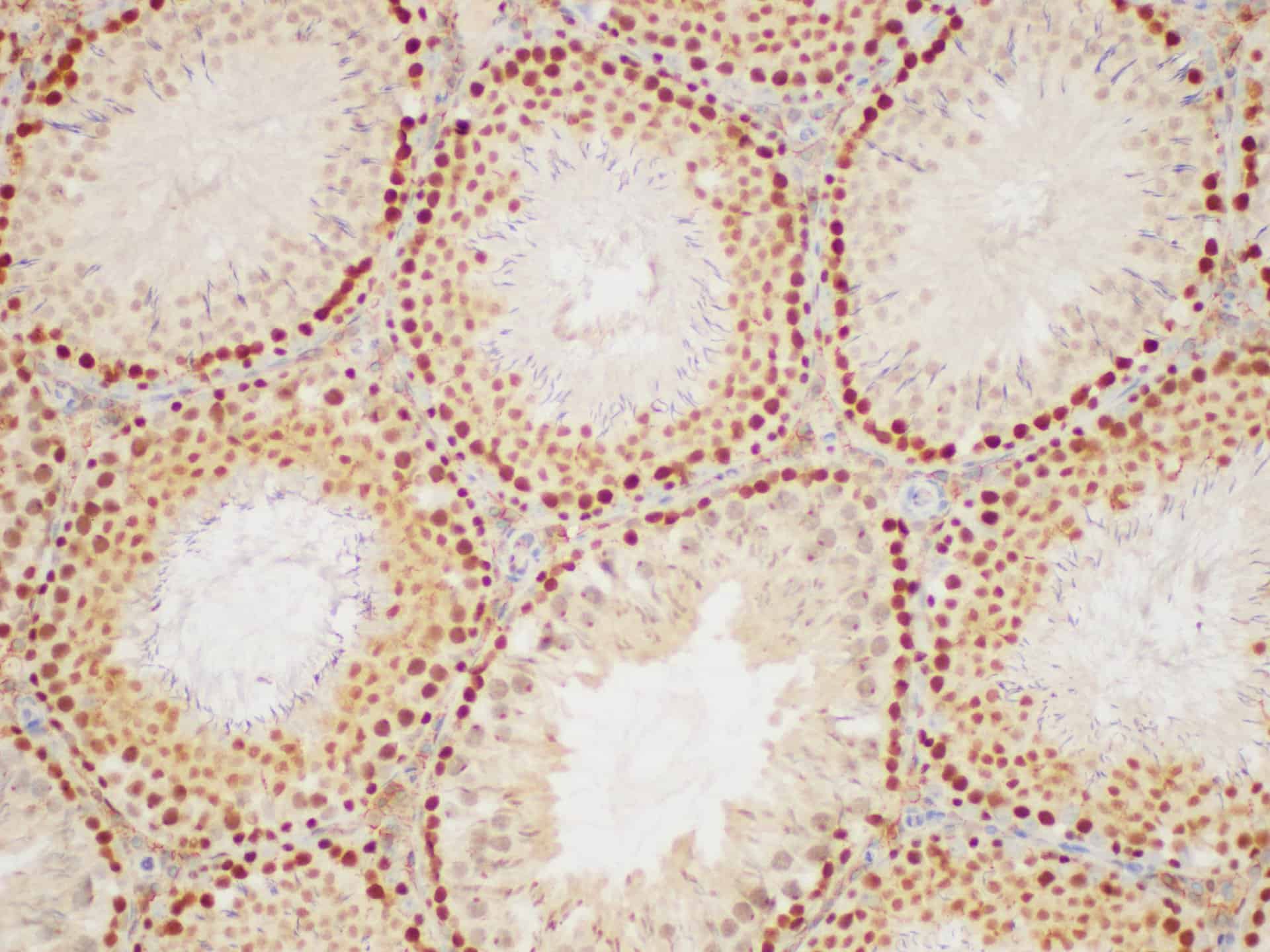 Purified Anti-Mouse/Human GAL3 Antibody[M3/38]-产品推荐-1