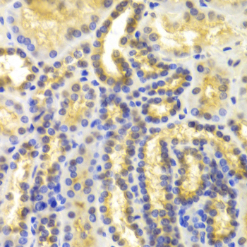 Immunohistochemistry of paraffin-embedded Human kidney using EIF5A Polyclonal Antibody at dilution of  1:100 (40x lens).