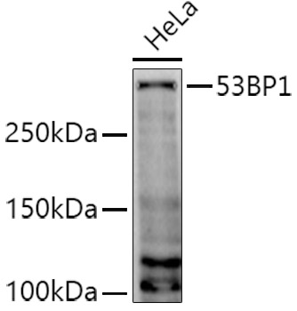 Western blot analysis of extracts of HeLa cells using 53BP1 Polyclonal Antibody at 1:1000 dilution.