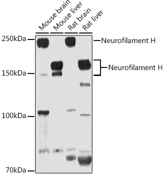 Western blot analysis of extracts of various cell lines using Neurofilament H Polyclonal Antibody at 1:1000 dilution.