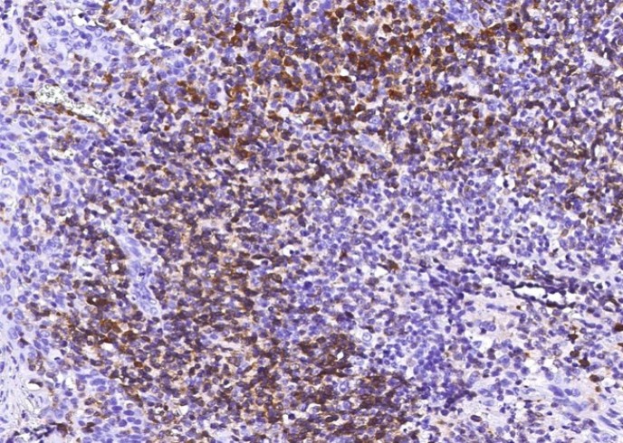 Recombinant CD79A/Ig-alpha Monoclonal Antibody - small - 1