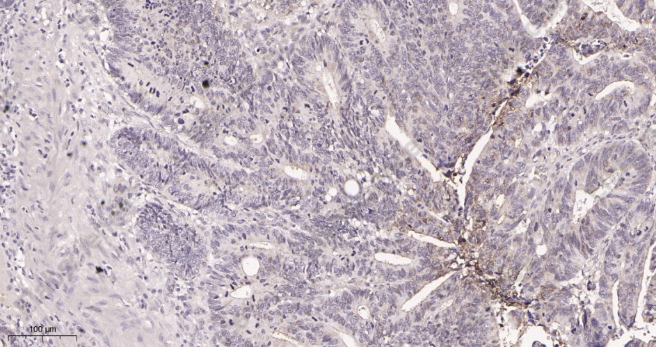 Recombinant Carbonic Anhydrase 9 Monoclonal Antibody - 2