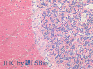 SNAP25 Polyclonal Antibody - 2