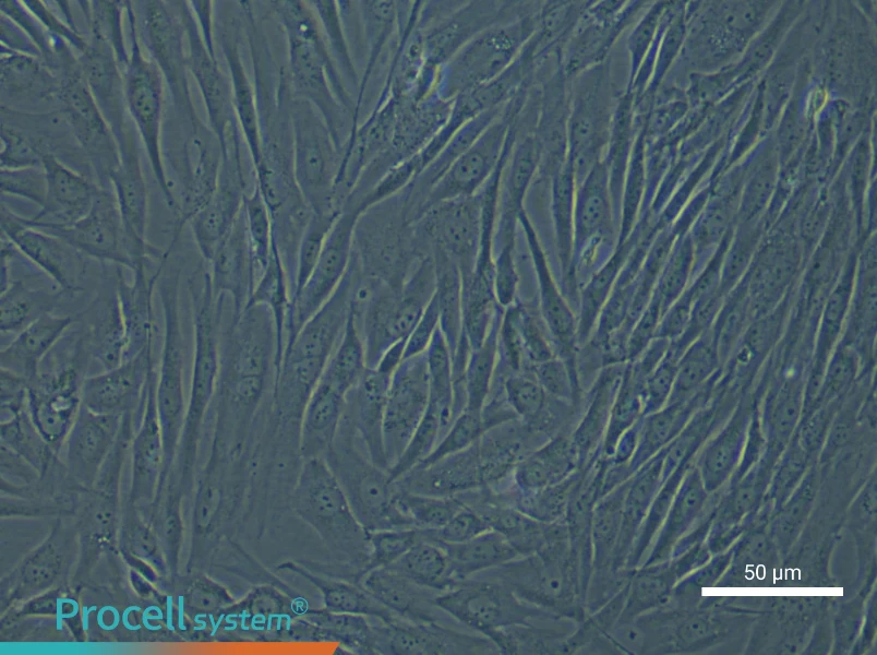 Human Intervertebral Disc Nucleus Pulposu (Primary cell immortalization) Cell Complete Medium - small - 6