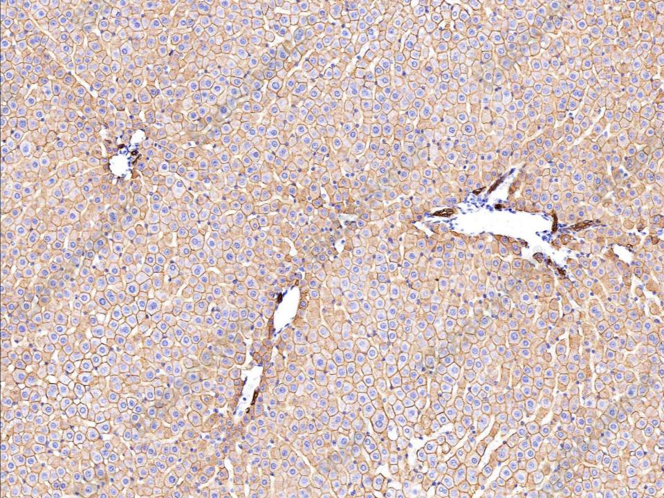 Recombinant Cytokeratin 7/KRT7 Monoclonal Antibody - 3