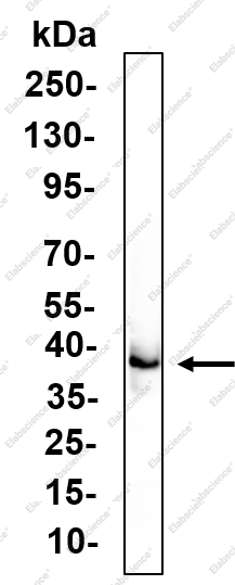 Recombinant Cathepsin B Monoclonal Antibody - 4