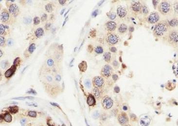 Recombinant CTCFL Monoclonal Antibody-searchlist-2