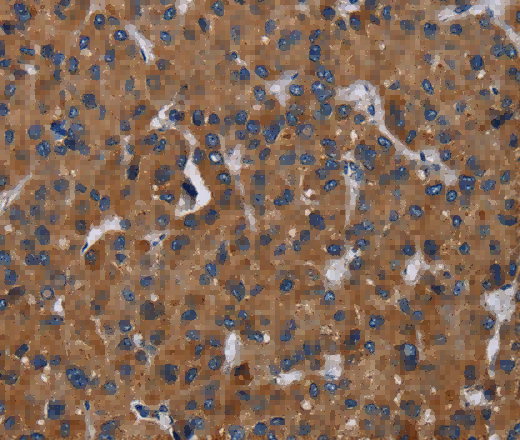 LZTFL1 Polyclonal Antibody - 2