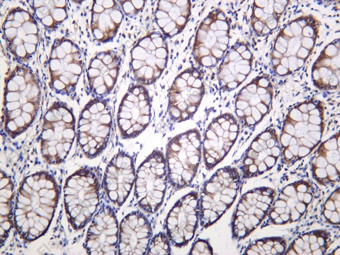 Recombinant CaMKIIδ Monoclonal Antibody - 1