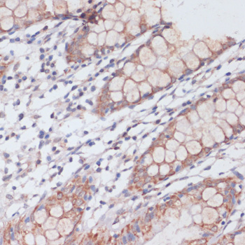 Immunohistochemistry of paraffin-embedded Human colon using MBTPS1 Polyclonal Antibody at dilution of 1:100 (40x lens).