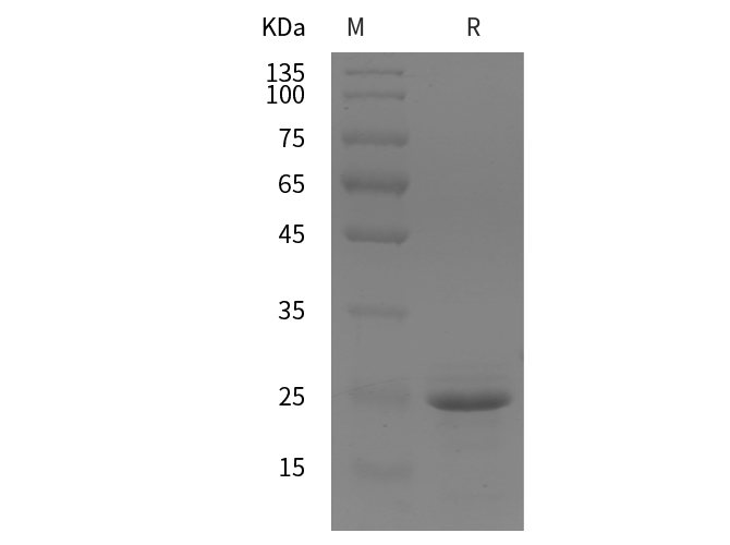Recombinant Human IL22 Protein(Avi,His Tag)-产品推荐-1