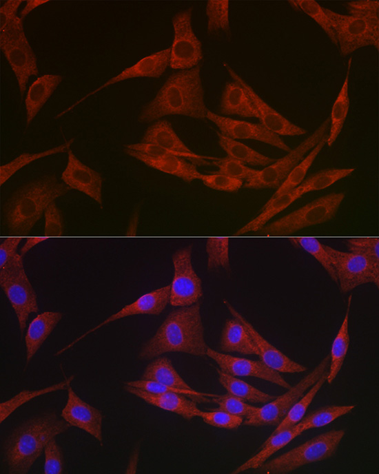 Immunofluorescence analysis of NIH/3T3 cells using Bcl-2 Polyclonal Antibody at dilution of 1:200. Blue: DAPI for nuclear staining.