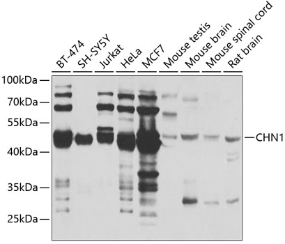 Western blot analysis of extracts of various cell lines using CHN1 Polyclonal Antibody at 1:1000 dilution.