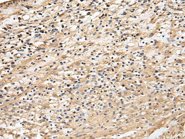 Immunohistochemistry of paraffin-embedded Human brain tissue  using CRACR2A Polyclonal Antibody at dilution of 1:60(?200)