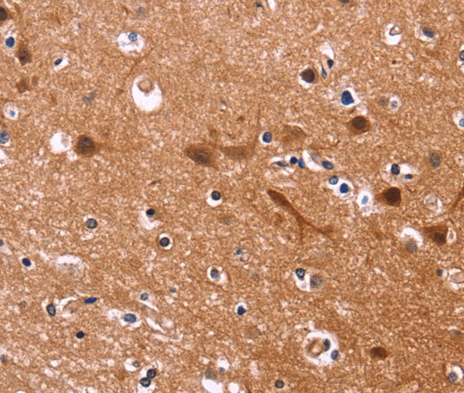 Immunohistochemistry of paraffin-embedded Human brain  tissue using MSH4 Polyclonal Antibody at dilution 1:30