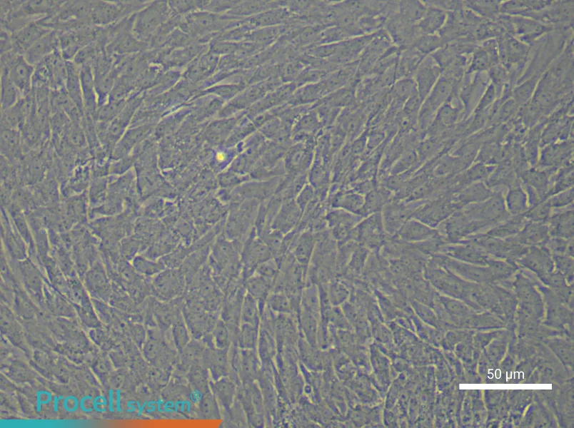 Human Gastric Cancer Fibroblast Complete Medium - 6