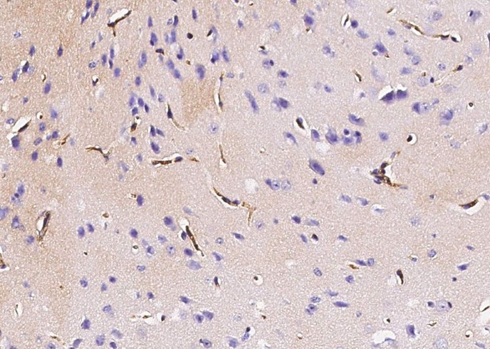 Recombinant Podoplanin/PDPN Monoclonal Antibody - small - 2