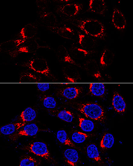 Immunofluorescence analysis of HeLa cells using USO1 Polyclonal Antibody at dilution of  1:200 (60x lens). Blue: DAPI for nuclear staining.