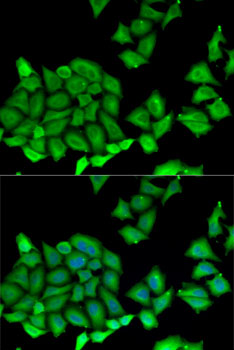 Immunofluorescence analysis of U2OS cells using RPS7 Polyclonal Antibody