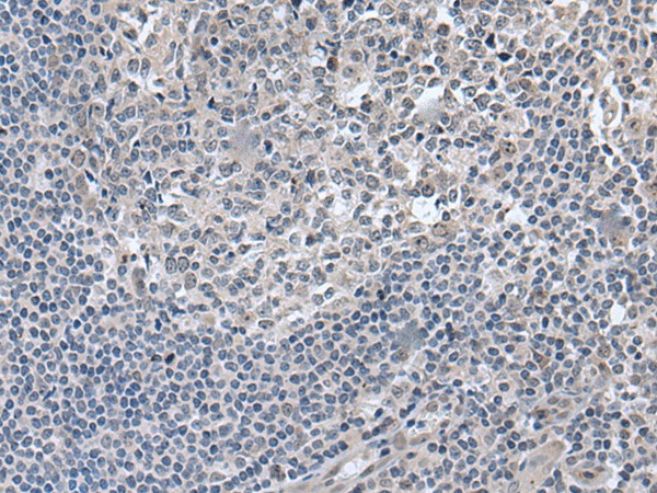 Immunohistochemistry of paraffin-embedded Human tonsil tissue  using EDARADD Polyclonal Antibody at dilution of 1:50(?200)