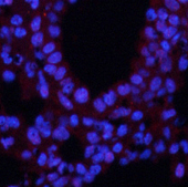 Immunofluorescence analysis of Mouse lung tissue using Phospho-CREB1 (Ser133) Polyclonal Antibody at dilution of 1:200