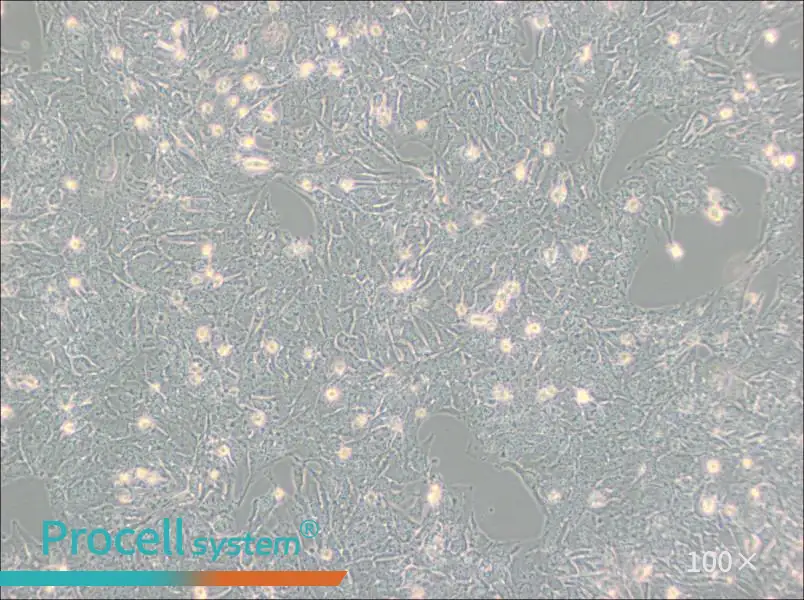 TTA1 Cell Complete Medium - 1