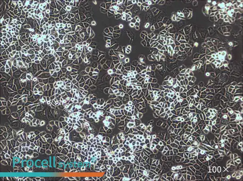 AU565 Cell Complete Medium - 1