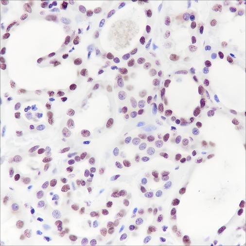 Recombinant HMGB1 Monoclonal Antibody - small - 2