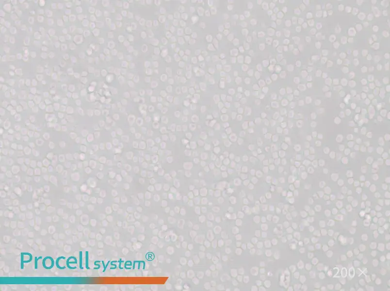 SU-DHL-8 Cell Complete Medium - 5