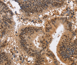 KCNG2 Polyclonal Antibody - 2