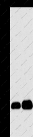 LIN28B Polyclonal Antibody - 1