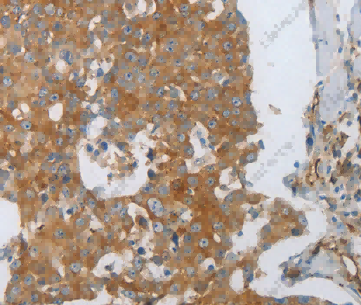 CD31 Polyclonal Antibody - 2