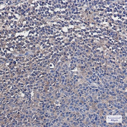 Recombinant VCP Monoclonal Antibody - 4