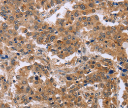 EPDR1 Polyclonal Antibody - 2