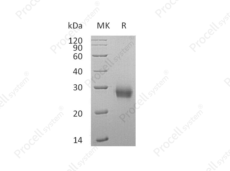 RANK/TNFRSF11A/CD265 (C-6His), Human, Recombinant
