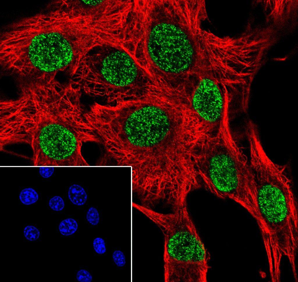 Recombinant Histone H3 (Mono Methyl Arg2) Monoclonal Antibody - small - 4