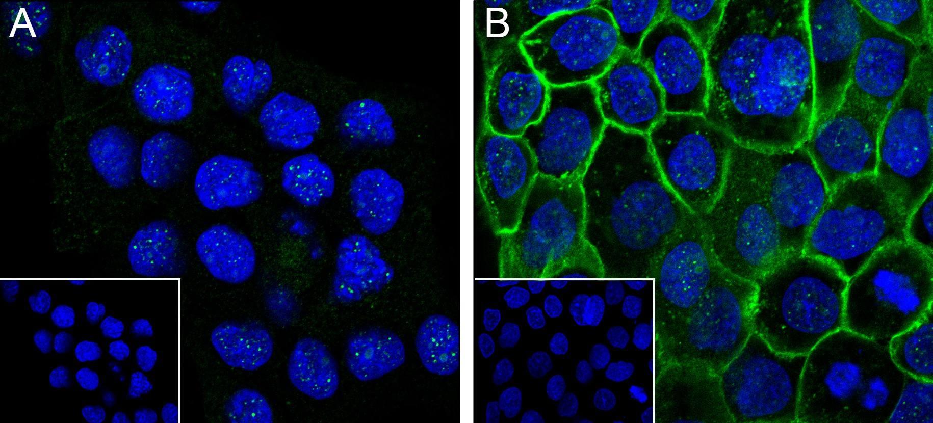 Recombinant Phospho-EGFR (Tyr1173) Monoclonal Antibody - 2