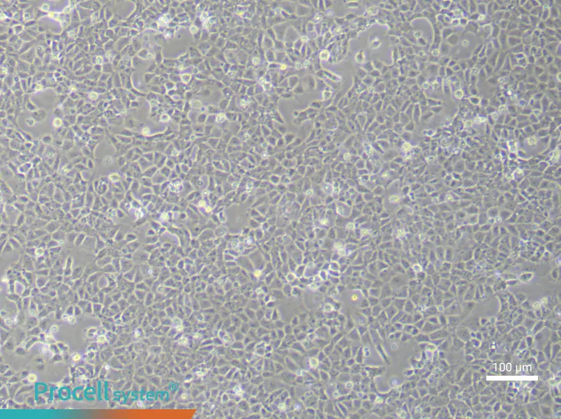 Rat Cardiac Fibroblasts (Primary cell immortalization)Rat Cardiac Fibroblasts (Primary cell immortalization) - 3