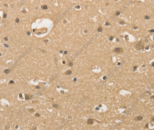 ALDH8A1 Polyclonal Antibody - 3