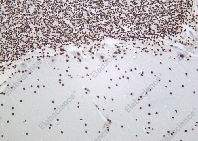 Recombinant Histone H3 (Tri Methyl Lys9) Monoclonal Antibody - 1