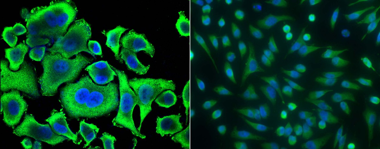 Recombinant ACY1/Aminoacylase-1 Monoclonal Antibody-searchlist-1