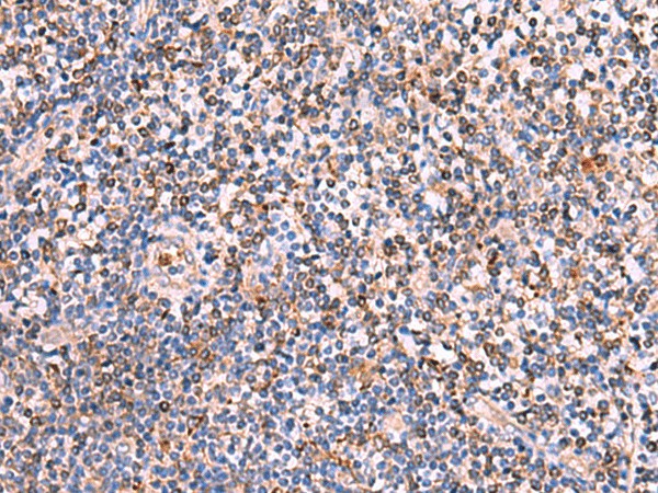 Immunohistochemistry of paraffin-embedded Human tonsil tissue  using SOX2 Polyclonal Antibody at dilution of 1:35(?200)