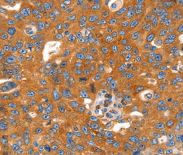 CAP2 Polyclonal Antibody - 2