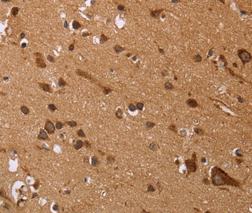 Immunohistochemistry of paraffin-embedded Human brain tissue using EDN3 Polyclonal Antibody at dilution 1:50