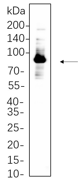 Recombinant Glycogen Synthase Monoclonal Antibody-searchlist-1