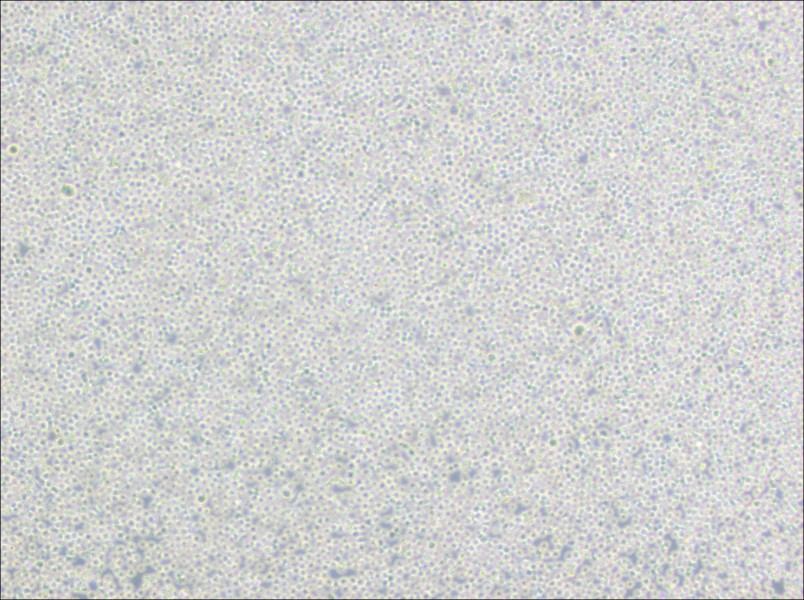 BALL-1 Cell Complete Medium-searchlist-1