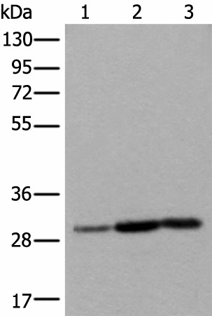 Western blot analysis of Human heart tissue A431 cell Human fetal liver tissue lysates  using SNRPA Polyclonal Antibody at dilution of 1:550