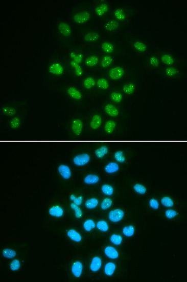 Immunofluorescence analysis of HeLa cells using BMI1 Polyclonal Antibody