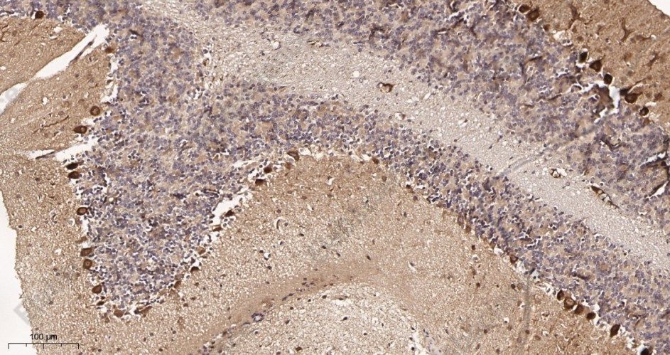 Recombinant S6K1 Monoclonal Antibody - 2